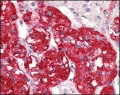 Immunohistochemistry-Paraffin: STYK1 Antibody (2H2F10) - BSA Free [NBP1-47511]