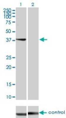 Western Blot: STYK1 Antibody (3A8) [H00055359-M01]