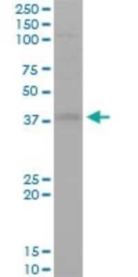 Western Blot: STYK1 Antibody (3D2) [H00055359-M02]