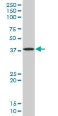 Western Blot: STYK1 Antibody (3D2) [H00055359-M02]