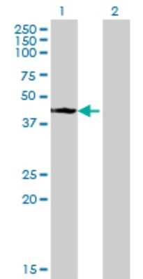 Western Blot: STYK1 Antibody (3D2) [H00055359-M02]