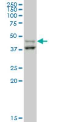 Western Blot: STYK1 Antibody (4A4) [H00055359-M03]