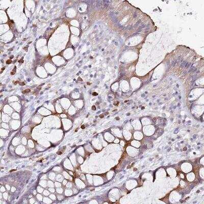 Immunohistochemistry-Paraffin: STYK1 Antibody [NBP2-13398]