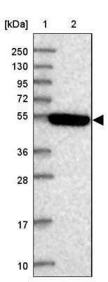 Western Blot: STYK1 Antibody [NBP2-13398]