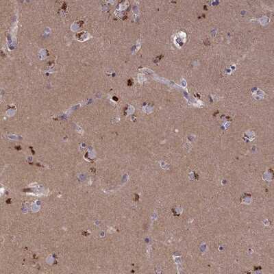 Immunohistochemistry-Paraffin: STYX Antibody [NBP1-92457]