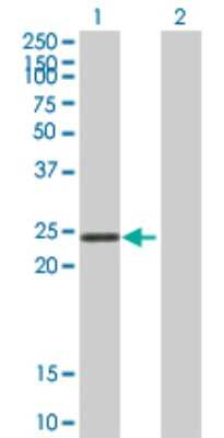 Western Blot: STYX Antibody [H00006815-B01P]