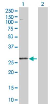 Western Blot: STYX Antibody [H00006815-D01P]