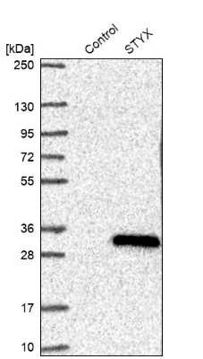 Western Blot: STYX Antibody [NBP1-92457]