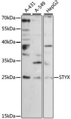 Western Blot: STYX AntibodyAzide and BSA Free [NBP2-94664]