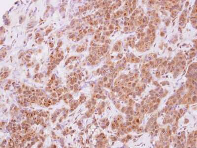 Immunohistochemistry-Paraffin: STYXL1 Antibody [NBP2-20528]