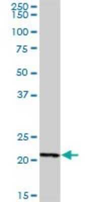 Western Blot: STYXL1 Antibody [H00051657-B02P]