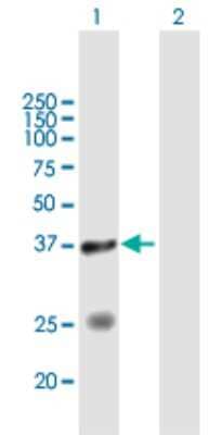 Western Blot: STYXL1 Antibody [H00051657-B02P]