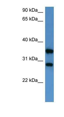 Western Blot: STYXL1 Antibody [NBP1-79814]