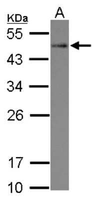 Western Blot: STYXL1 Antibody [NBP2-20528]