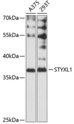 Western Blot: STYXL1 AntibodyAzide and BSA Free [NBP2-93417]