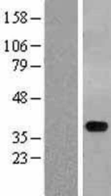 Western Blot: STYXL1 Overexpression Lysate [NBL1-16592]