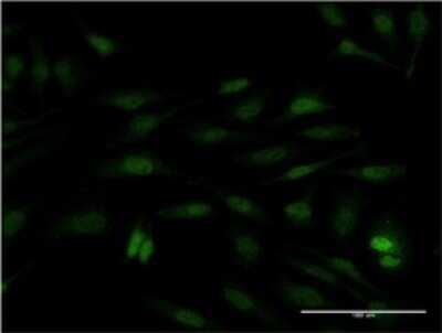Immunocytochemistry/ Immunofluorescence: SUB1 Antibody (3A1) [H00010923-M11]