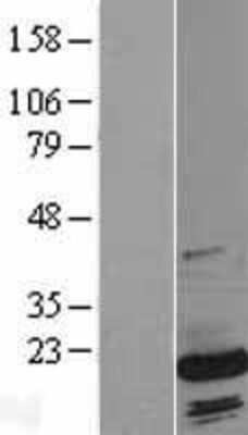 Western Blot: SUB1 Overexpression Lysate [NBL1-16593]