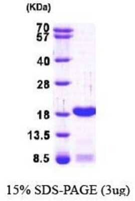 SDS-PAGE: Recombinant Human SUB1 His Protein [NBP1-44459]