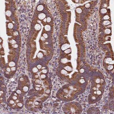 Immunohistochemistry: SUCLA2 Antibody [NBP2-56491]