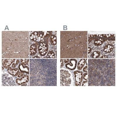 Immunohistochemistry-Paraffin: SUCLA2 Antibody [NBP1-85860]