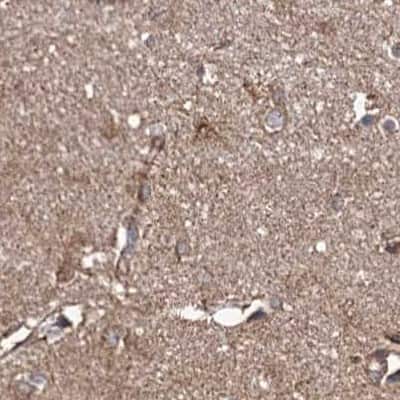 Immunohistochemistry-Paraffin: SUCLA2 Antibody [NBP1-85860]