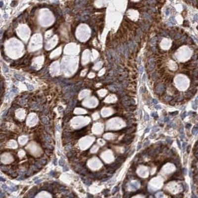 Immunohistochemistry-Paraffin: SUCLA2 Antibody [NBP1-85860]