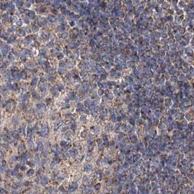 Immunohistochemistry-Paraffin: SUCLA2 Antibody [NBP1-85860]
