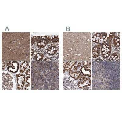 Immunohistochemistry-Paraffin: SUCLA2 Antibody [NBP2-55488]