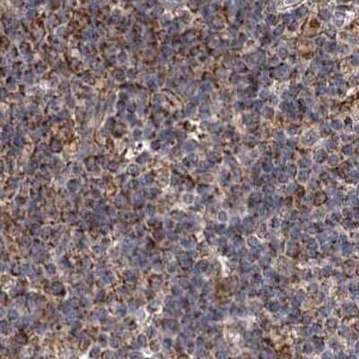 Immunohistochemistry-Paraffin: SUCLA2 Antibody [NBP2-55488]