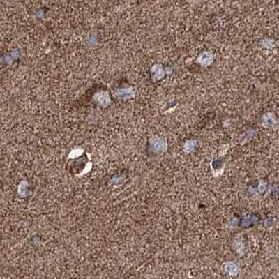 Immunohistochemistry-Paraffin: SUCLA2 Antibody [NBP2-55488]