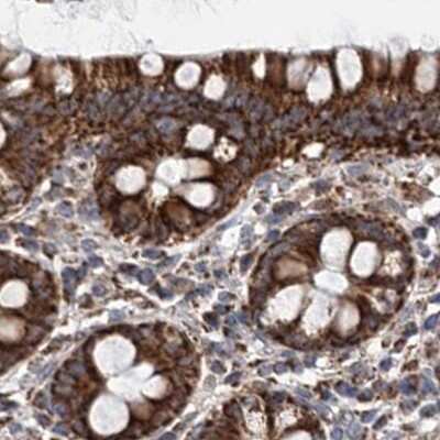 Immunohistochemistry-Paraffin: SUCLA2 Antibody [NBP2-55488]