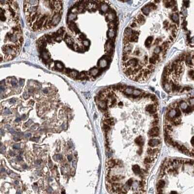 Immunohistochemistry-Paraffin: SUCLA2 Antibody [NBP2-55488]