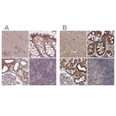 Immunohistochemistry-Paraffin: SUCLA2 Antibody [NBP2-56491]