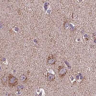 Immunohistochemistry-Paraffin: SUCLA2 Antibody [NBP2-56491]