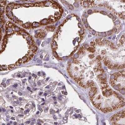 Immunohistochemistry-Paraffin: SUCLA2 Antibody [NBP2-56491]