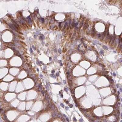 Immunohistochemistry-Paraffin: SUCLA2 Antibody [NBP2-56491]