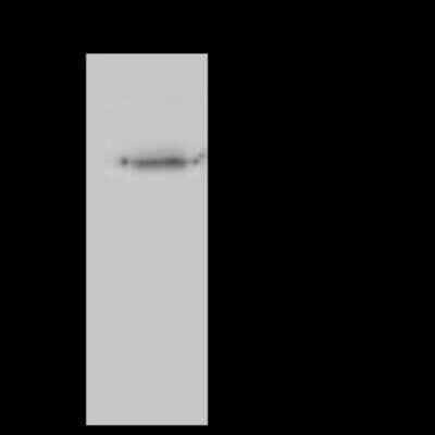 Immunoprecipitation: SUCLA2 Antibody [NBP2-97755]