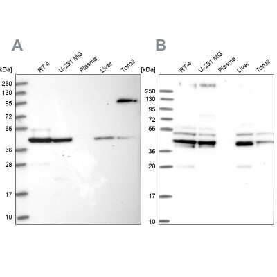 Western Blot: SUCLA2 Antibody [NBP2-55488]