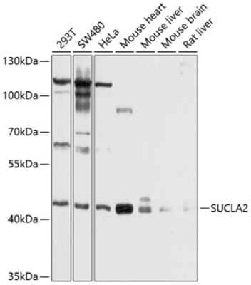 Western Blot: SUCLA2 AntibodyBSA Free [NBP2-94539]