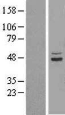 Western Blot: SUCLA2 Overexpression Lysate [NBL1-16594]