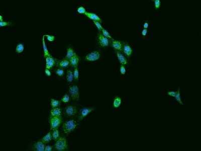 Immunocytochemistry/ Immunofluorescence: SUCLG1 Antibody [NBP2-97325]