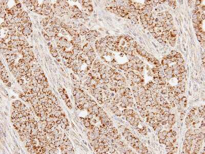 Immunohistochemistry-Paraffin: SUCLG1 Antibody [NBP1-32728]