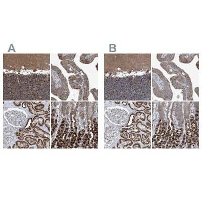 Immunohistochemistry-Paraffin: SUCLG1 Antibody [NBP1-89489]