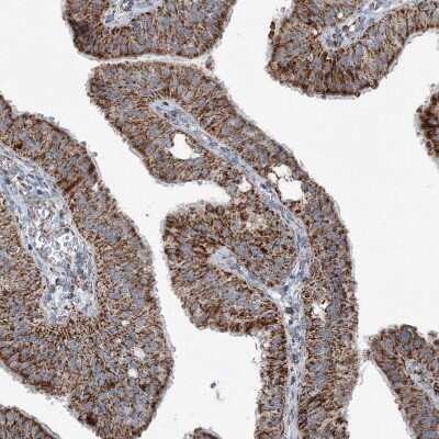 Immunohistochemistry-Paraffin: SUCLG1 Antibody [NBP1-89489]