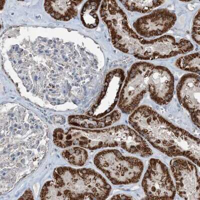 Immunohistochemistry-Paraffin: SUCLG1 Antibody [NBP1-89489]