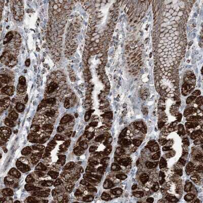 Immunohistochemistry-Paraffin: SUCLG1 Antibody [NBP1-89489]