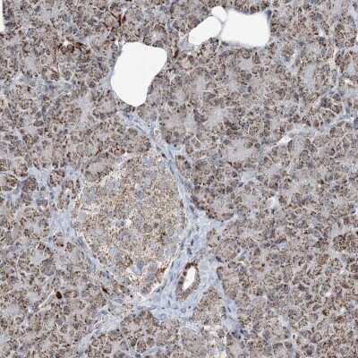 Immunohistochemistry-Paraffin: SUCLG1 Antibody [NBP2-38318]