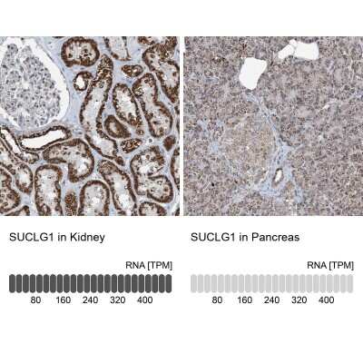 Immunohistochemistry-Paraffin: SUCLG1 Antibody [NBP2-38318]