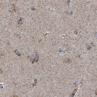 Immunohistochemistry-Paraffin: SUCLG1 Antibody [NBP2-38318]